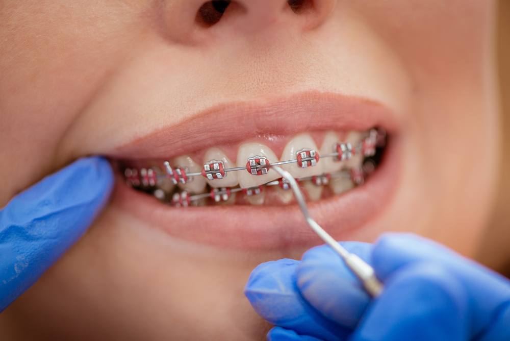 Langley Orthodontics