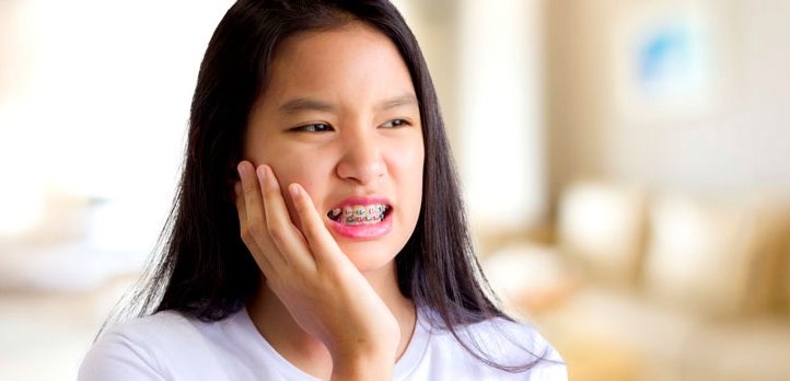 braces