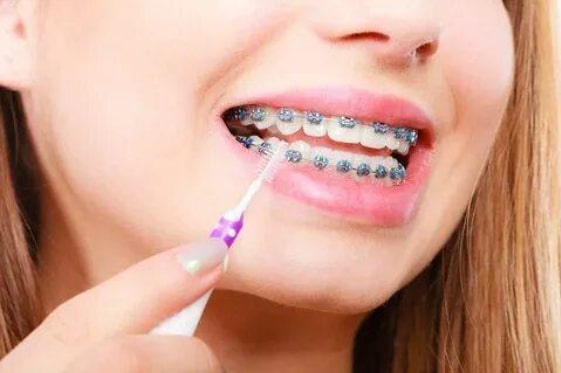 girl flossing